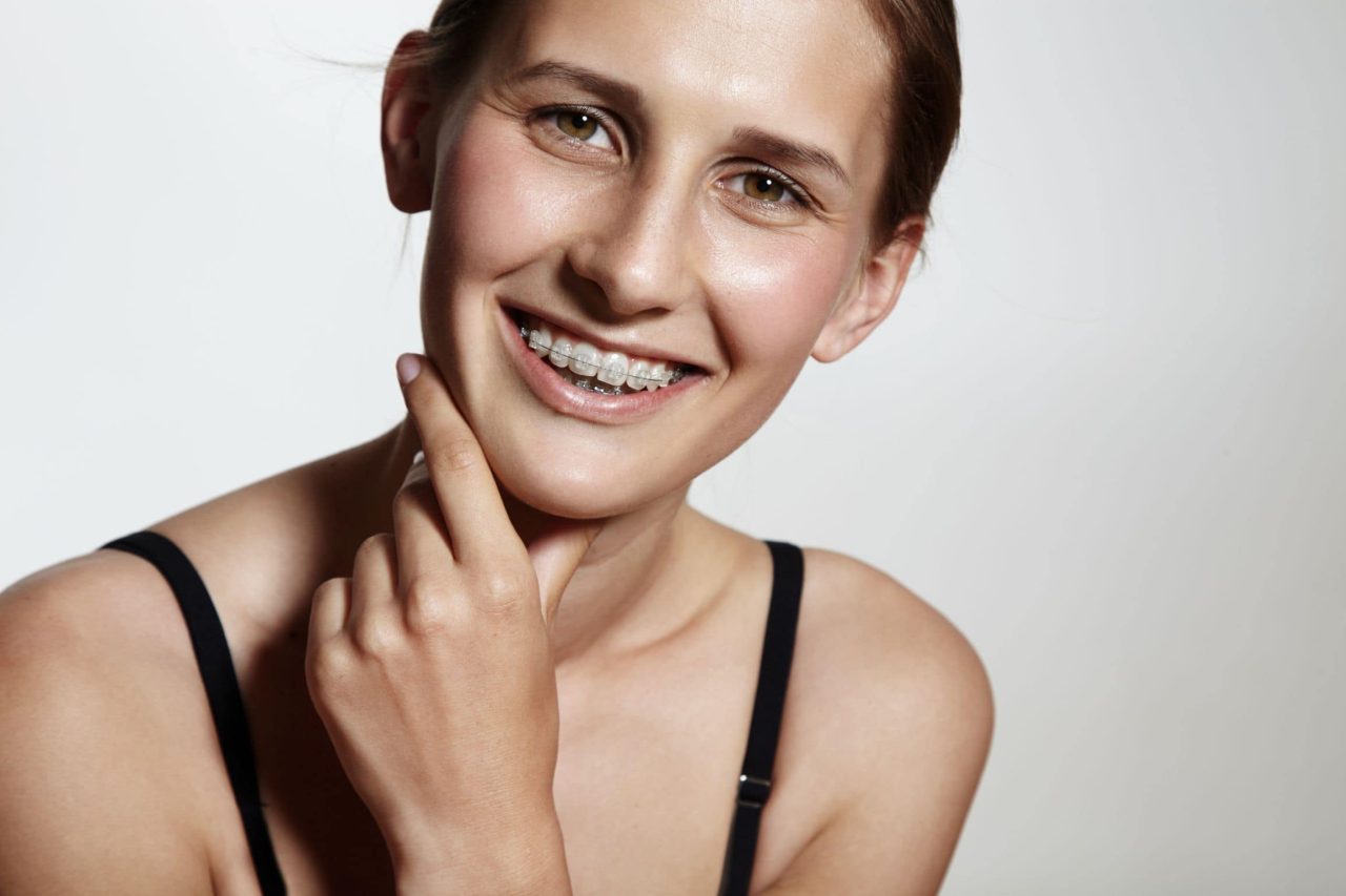 Braces in Lafayette, LA