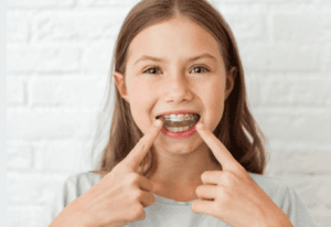 Braces and Sports