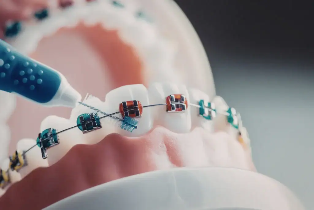 How Technology Makes Braces More Comfortable Than Ever?