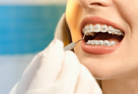 Orthodontic treatment