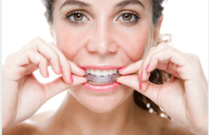 Invisalign for Adults