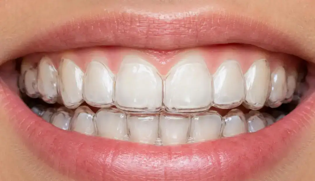 Night Aligners