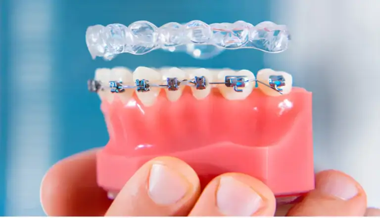 Can I Get Braces with Medicaid